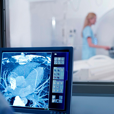 Intravascular Imaging (IVUS / OCT)