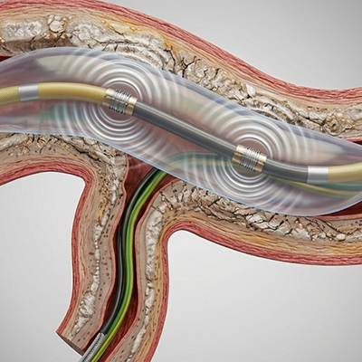 Rotablation / Intravascular Lithotripsy